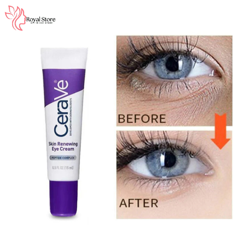 Skin Renewing Eye Cream – Anti-Aging Under-Eye Treatment Skin Renewing Eye Cream